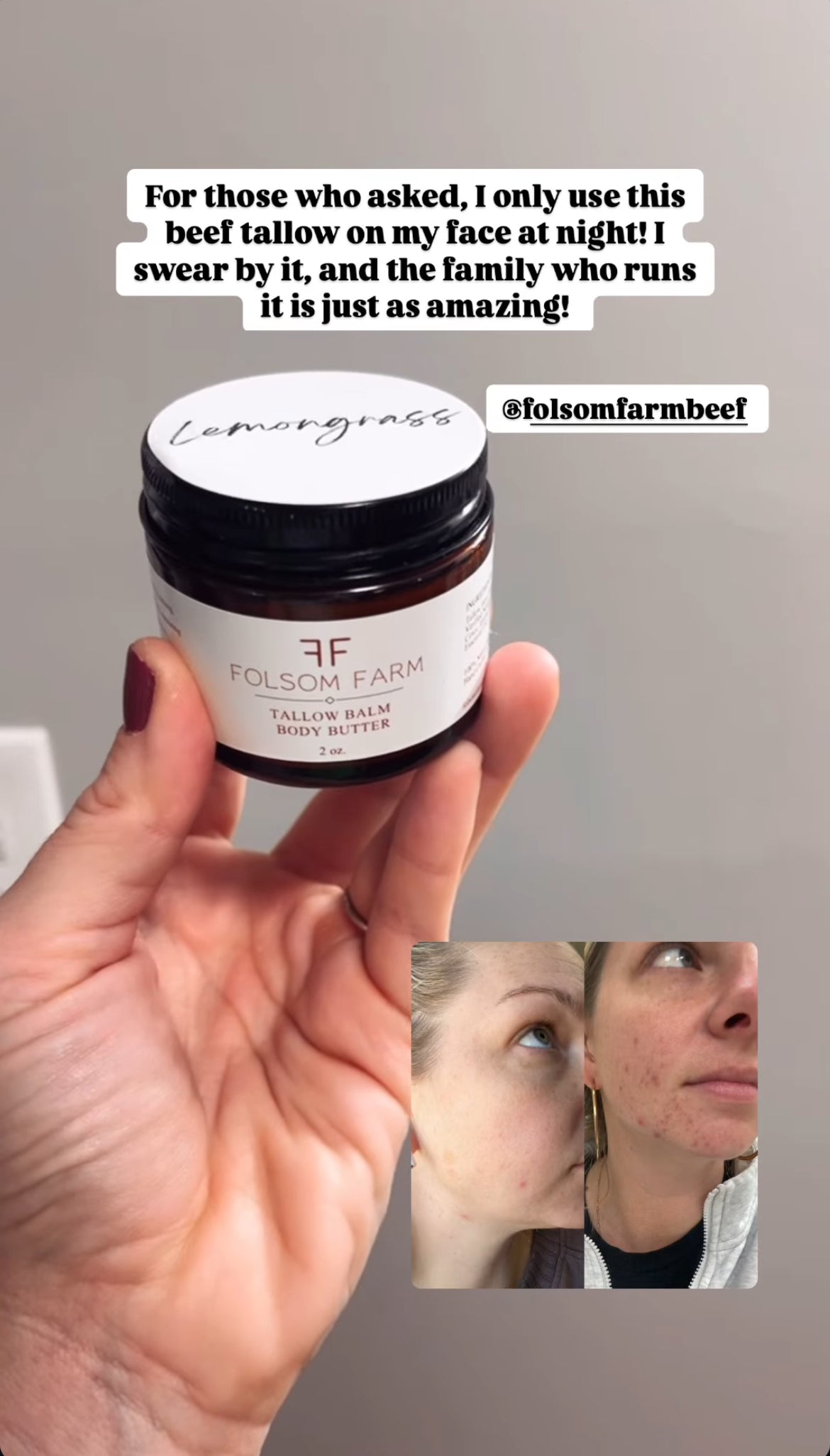 Tallow Balm (All Natural Skincare)